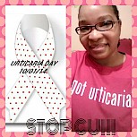 Almost four years with Chronic Idiopathic Urticaria is one too many. I